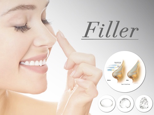 Nâng mũi không cần phẫu thuật bằng Filler an toàn, hiệu quả thẩm mỹ cao