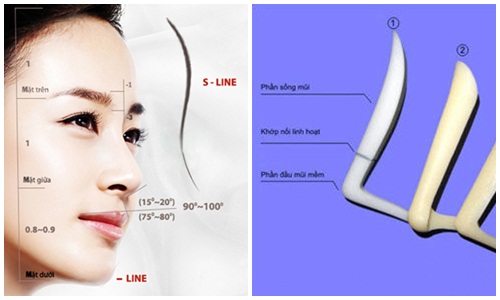 Kết quả nâng mũi S line 3D vĩnh viễn nhờ chất liệu